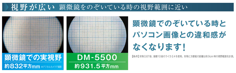 顕微鏡デジタルカメラシステム DM-5000シリーズ