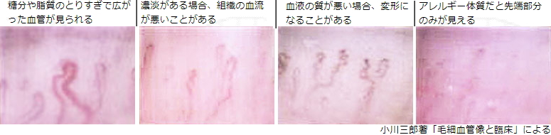 血流スコープMJ-BL10ゴースト血管スコープ