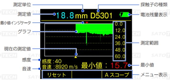 Bスコープ表示