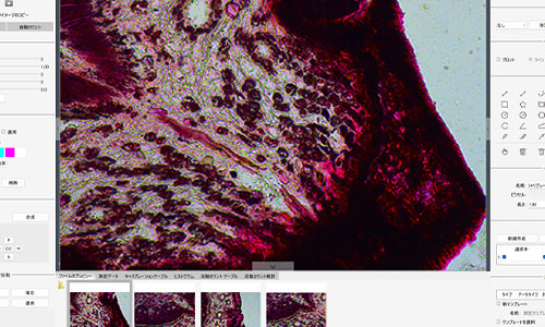 ステッチング機能