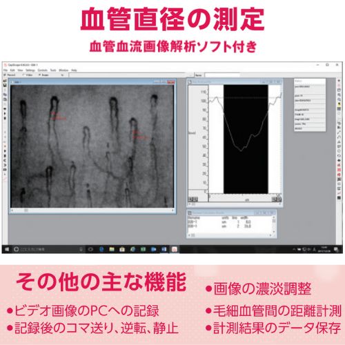 血管血流画像解析ソフト付き