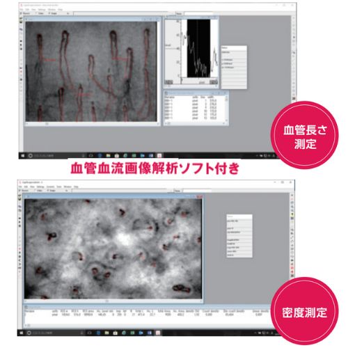 血管長さ測定、密度測定